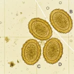 Pig roundworm eggs under microscope showing Ascaris suum parasites in a faecal flotation test