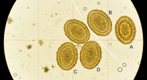 Pig roundworm eggs under microscope showing Ascaris suum parasites in a faecal flotation test