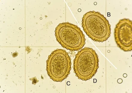 Pig roundworm eggs under microscope showing Ascaris suum parasites in a faecal flotation test